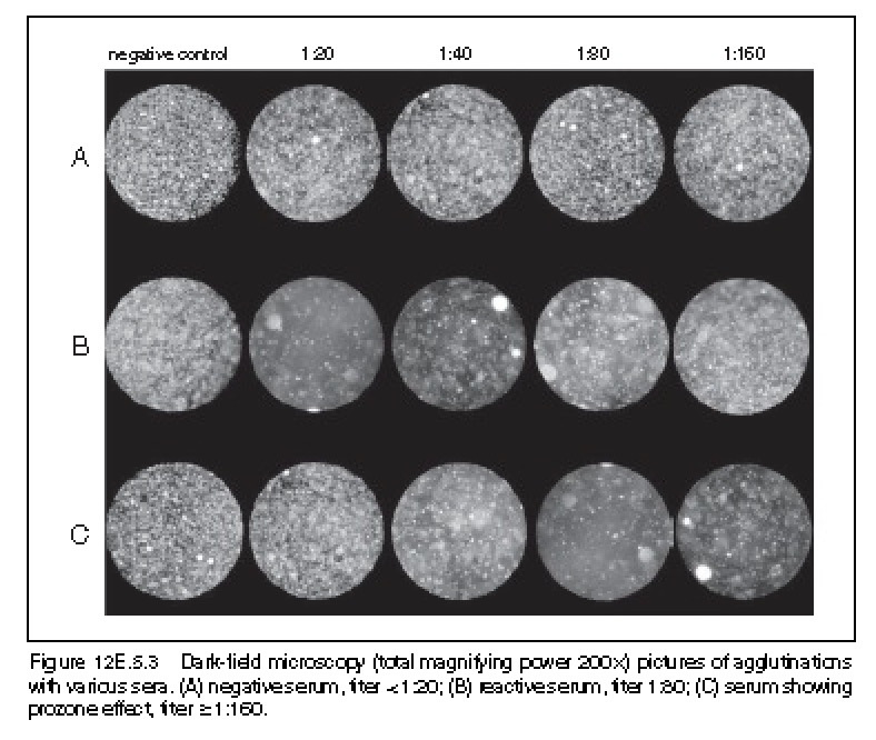 what-is-the-principle-behind-microagglutination-test-mat-echemi