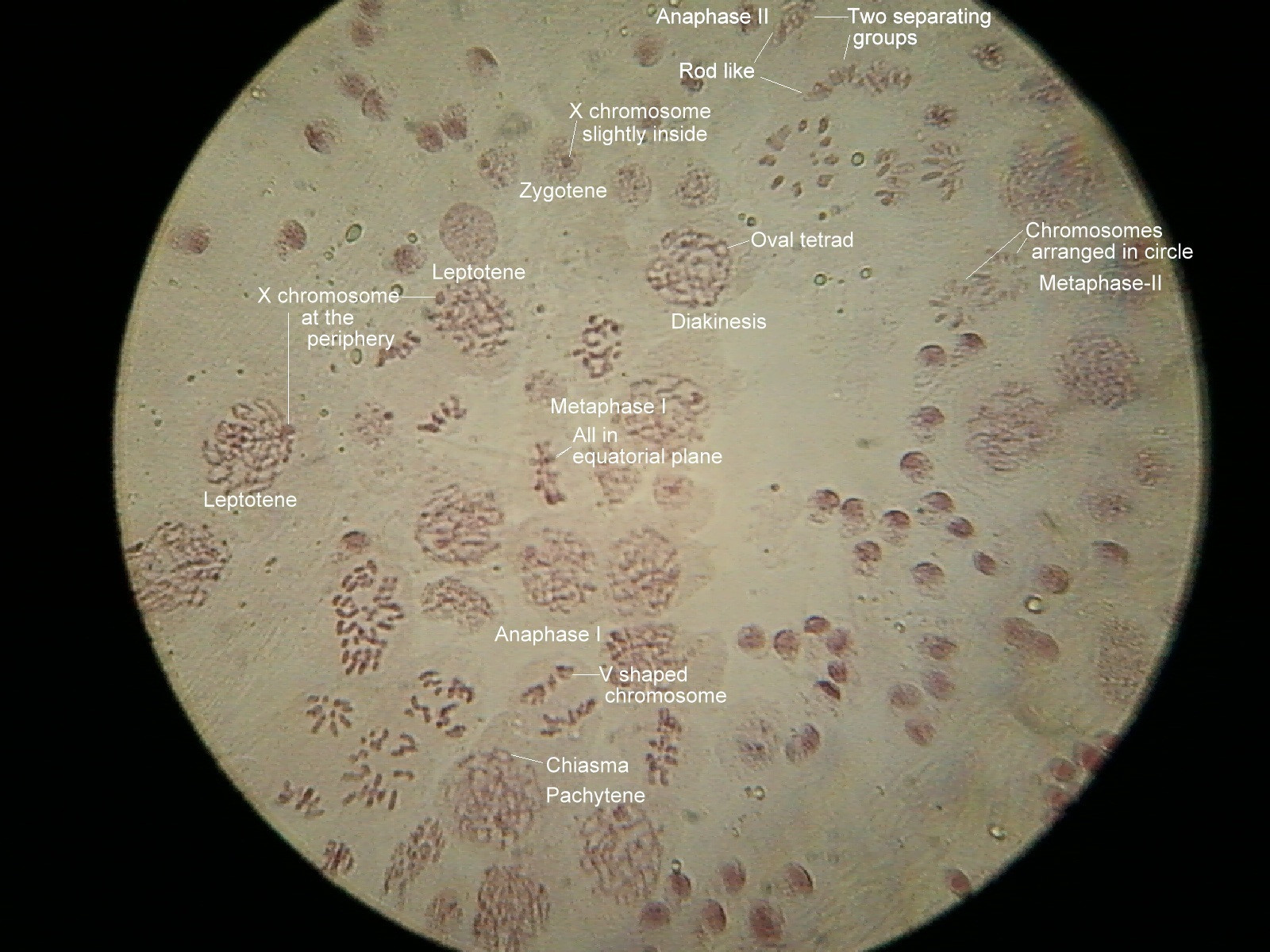 meiosis stages under microscope