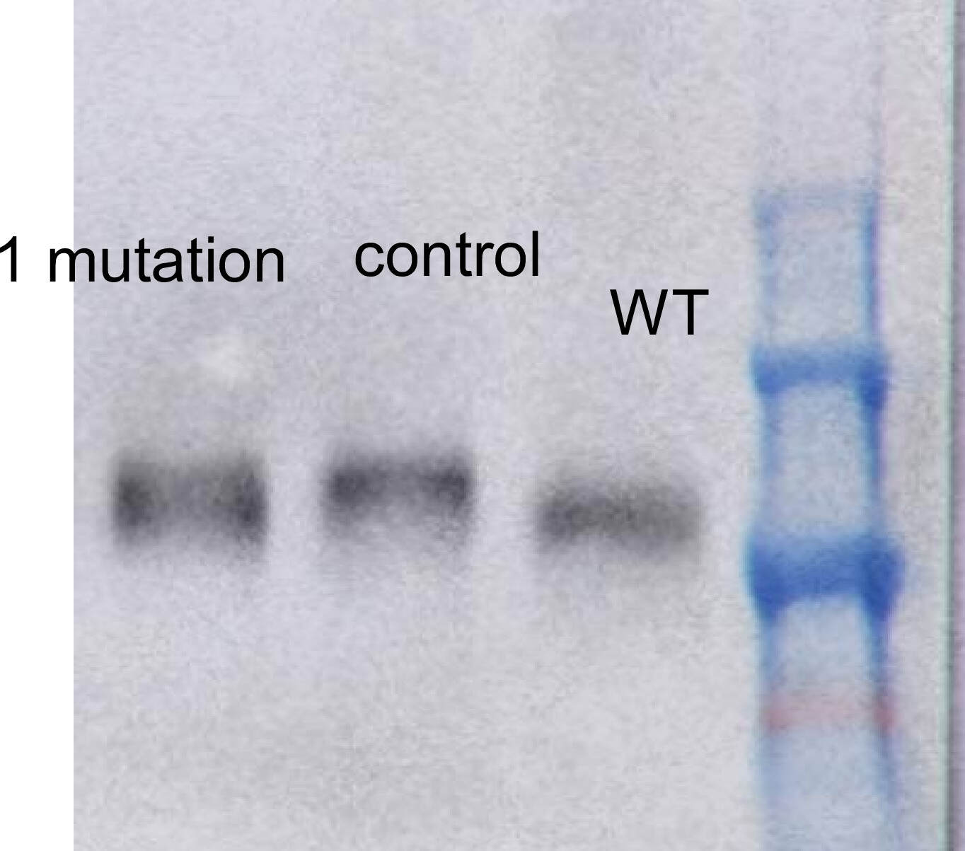 How to analyze phosphorylation shift by western blot? ECHEMI
