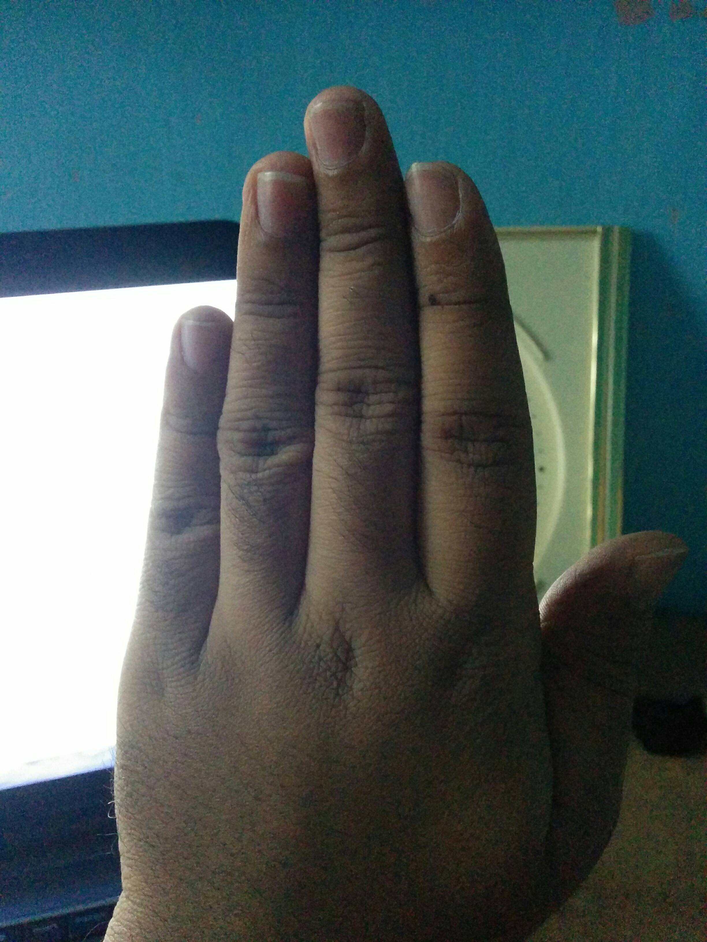 The alignment of fingers in our hand ECHEMI
