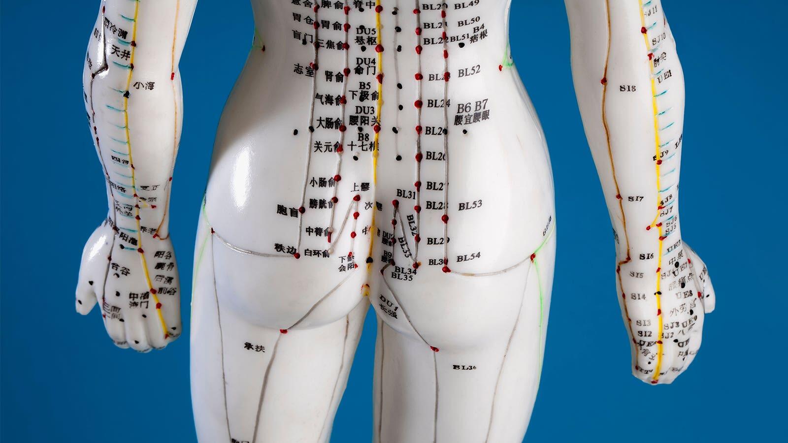 Acupuncture May Help Reduce Urinary Incontinence Episodes, Symptoms in